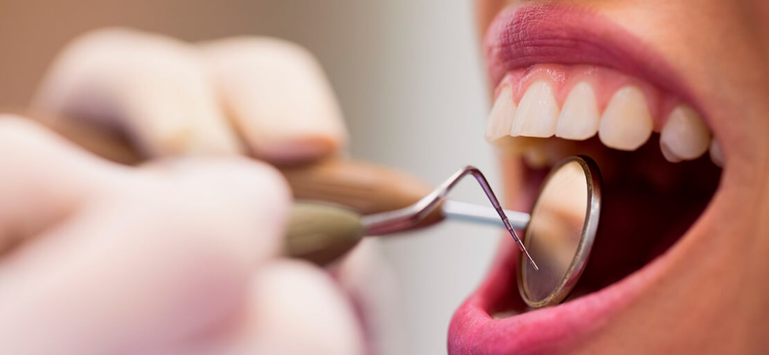 Mantención periodontal Providencia