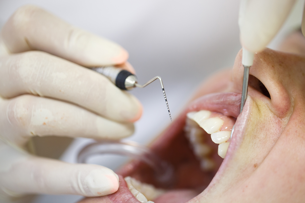Mantención periodontal La Dehesa