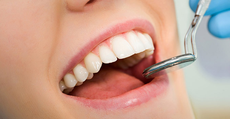 Mantención periodontal San Bernardo